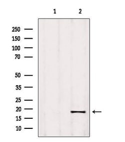 Invitrogen RPP25L Polyclonal Antibody 100 &mu;L; Unconjugated:Antibodies,