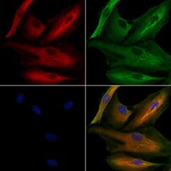 Invitrogen AKR1C4 Polyclonal Antibody 100 &mu;L; Unconjugated:Antibodies,
