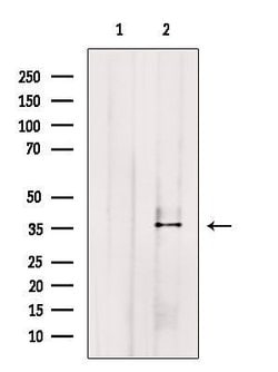 Invitrogen AKR1C4 Polyclonal Antibody 100 &mu;L; Unconjugated:Antibodies,