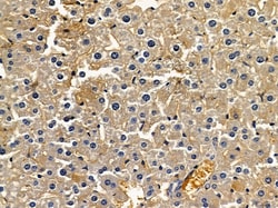 Invitrogen GALM Polyclonal Antibody 100 &mu;L | Buy Online | Invitrogen&trade; | Fisher Scientific