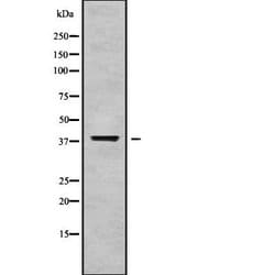 Invitrogen GALM Polyclonal Antibody 100 &mu;L | Buy Online | Invitrogen&trade; | Fisher Scientific