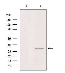 Invitrogen ASAH3 Polyclonal Antibody 100 &mu;L; Unconjugated:Antibodies,