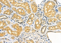 Invitrogen SERPINA2 Polyclonal Antibody 100 &mu;L; Unconjugated:Antibodies,
