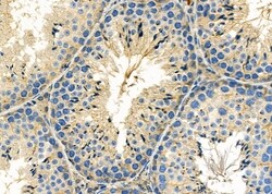 Invitrogen SERPINA2 Polyclonal Antibody 100 &mu;L; Unconjugated:Antibodies,