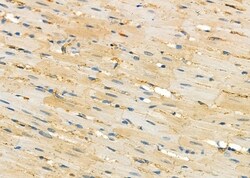 Invitrogen SERPINA2 Polyclonal Antibody 100 &mu;L; Unconjugated:Antibodies,