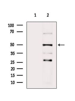 Invitrogen SERPINA2 Polyclonal Antibody 100 &mu;L; Unconjugated:Antibodies,