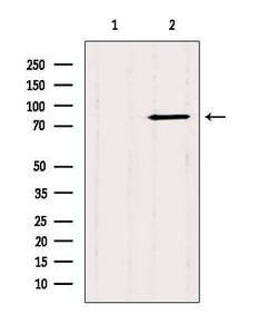 Invitrogen CTNNAL1 Polyclonal Antibody 100 &mu;L; Unconjugated:Antibodies,