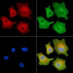 Invitrogen Alsin Polyclonal Antibody 100 &mu;L; Unconjugated:Antibodies,
