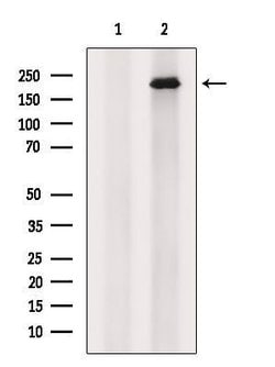 Invitrogen ALMS1 Polyclonal Antibody 100 &mu;L; Unconjugated:Antibodies,