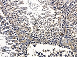 Invitrogen AMPD3 Polyclonal Antibody 100 &mu;L; Unconjugated:Antibodies,