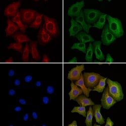 Invitrogen AAMP Polyclonal Antibody 100 &mu;L; Unconjugated:Antibodies,