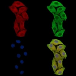 Invitrogen Angiopoietin 4 Polyclonal Antibody 100 &mu;L; Unconjugated:Antibodies,