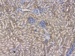 Invitrogen Angiopoietin 4 Polyclonal Antibody 100 &mu;L; Unconjugated:Antibodies,
