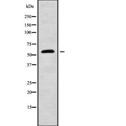 Invitrogen Angiopoietin 4 Polyclonal Antibody 100 &mu;L; Unconjugated:Antibodies,