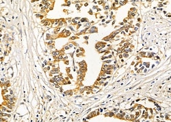 Invitrogen ANGPTL5 Polyclonal Antibody 100 &mu;L; Unconjugated:Antibodies,