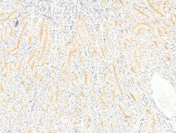 Invitrogen SLC4A9 Polyclonal Antibody 100 &mu;L; Unconjugated:Antibodies,