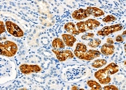 Invitrogen Aquaporin 11 Polyclonal Antibody 100 &mu;L; Unconjugated:Antibodies,
