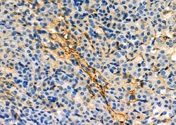 Invitrogen Aquaporin 11 Polyclonal Antibody 100 &mu;L; Unconjugated:Antibodies,