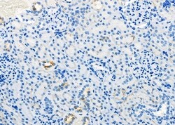 Invitrogen Aquaporin 11 Polyclonal Antibody 100 &mu;L; Unconjugated:Antibodies,
