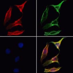 Invitrogen Aquaporin 11 Polyclonal Antibody 100 &mu;L; Unconjugated:Antibodies,