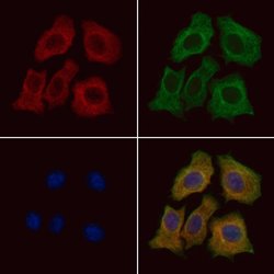 Invitrogen Aquaporin 11 Polyclonal Antibody 100 &mu;L; Unconjugated:Antibodies,