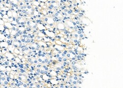 Invitrogen Aquaporin 6 Polyclonal Antibody 100 &mu;L; Unconjugated:Antibodies,