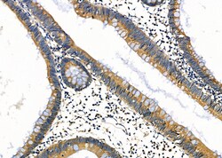 Invitrogen ARSH Polyclonal Antibody 100 &mu;L; Unconjugated:Antibodies,