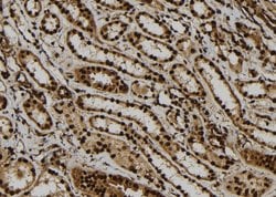 Invitrogen ATXN7L1 Polyclonal Antibody 100 &mu;L; Unconjugated:Antibodies,