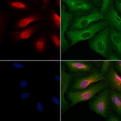 Invitrogen ATXN7L3 Polyclonal Antibody 100 &mu;L | Buy Online | Invitrogen&trade; | Fisher Scientific