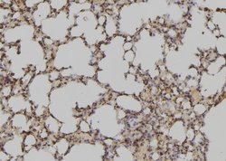 Invitrogen ATXN7L3 Polyclonal Antibody 100 &mu;L | Buy Online | Invitrogen&trade; | Fisher Scientific