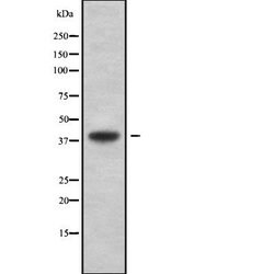 Invitrogen ATXN7L3 Polyclonal Antibody 100 &mu;L | Buy Online | Invitrogen&trade; | Fisher Scientific