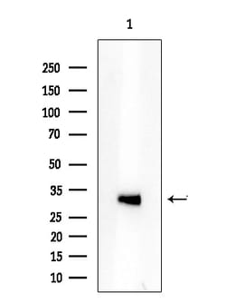 Invitrogen ATXN7L3 Polyclonal Antibody 100 &mu;L | Buy Online | Invitrogen&trade; | Fisher Scientific