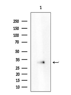 Invitrogen ATXN7L3 Polyclonal Antibody 100 &mu;L | Buy Online | Invitrogen&trade; | Fisher Scientific