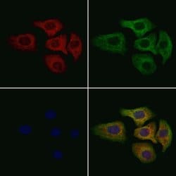 Invitrogen MT-ATP6 Polyclonal Antibody 100 &mu;L | Buy Online | Invitrogen&trade; | Fisher Scientific