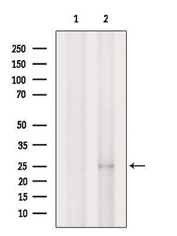 Invitrogen MT-ATP6 Polyclonal Antibody 100 &mu;L | Buy Online | Invitrogen&trade; | Fisher Scientific