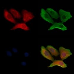 ATP5G1 Polyclonal Antibody:Antibodies, Polyclonal