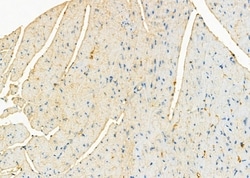ATP5G1 Polyclonal Antibody:Antibodies, Polyclonal