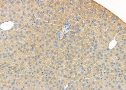 ATP5G1 Polyclonal Antibody:Antibodies, Polyclonal
