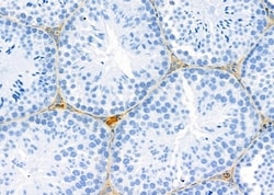 ATP5G1 Polyclonal Antibody:Antibodies, Polyclonal
