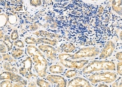 Invitrogen ATP Synthase O Polyclonal Antibody 100 &mu;L; Unconjugated:Antibodies,