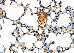 Invitrogen ABCA3 Polyclonal Antibody 100 &mu;L; Unconjugated:Antibodies,