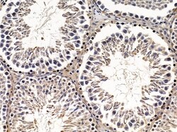 Invitrogen ABCC11 Polyclonal Antibody 100 &mu;L | Buy Online | Invitrogen&trade; | Fisher Scientific