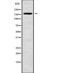 Invitrogen ABCC11 Polyclonal Antibody 100 &mu;L | Buy Online | Invitrogen&trade; | Fisher Scientific
