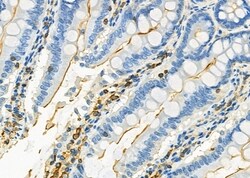 Invitrogen Kir4.1 (KCNJ10) Polyclonal Antibody 100 &mu;L; Unconjugated:Antibodies,