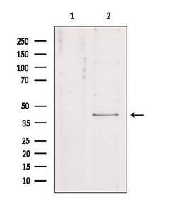 Invitrogen Kir4.1 (KCNJ10) Polyclonal Antibody 100 &mu;L; Unconjugated:Antibodies,