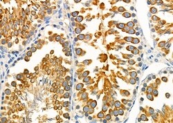 Invitrogen KCNJ14 Polyclonal Antibody 100 &mu;L; Unconjugated:Antibodies,