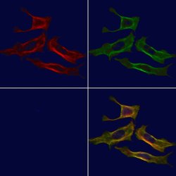 Invitrogen B3GALT6 Polyclonal Antibody 100 &mu;L; Unconjugated:Antibodies,