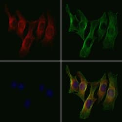 Invitrogen B4GALT2 Polyclonal Antibody 100 &mu;L; Unconjugated:Antibodies,
