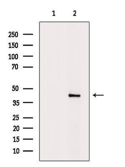 Invitrogen B4GALT2 Polyclonal Antibody 100 &mu;L; Unconjugated:Antibodies,