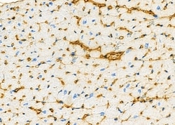 Invitrogen B4GALT4 Polyclonal Antibody 100 &mu;L | Buy Online | Invitrogen&trade; | Fisher Scientific